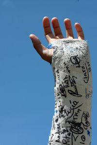 broken arm